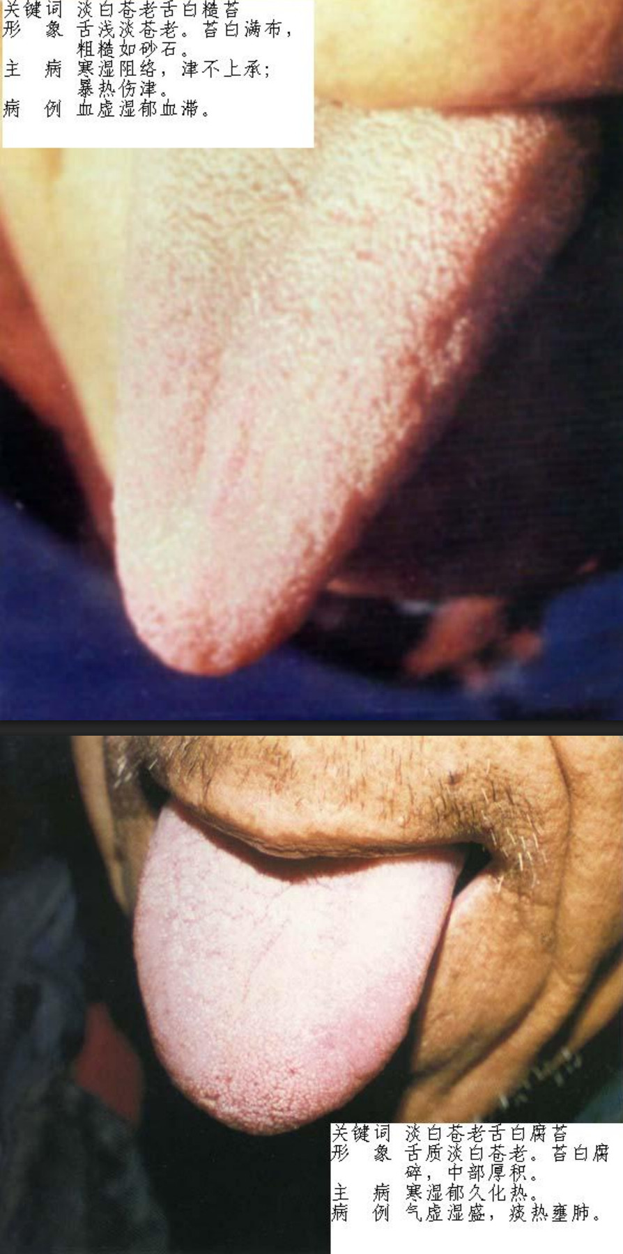 舌诊图片大全,舌诊图片大全 - 趣资源,舌诊图片,第1张